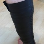 M.-Gastrocnemius-Applikation